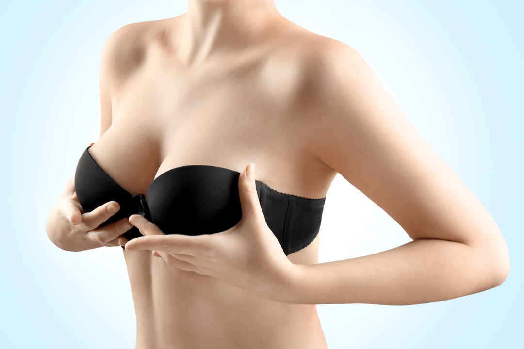 Breast augmentation