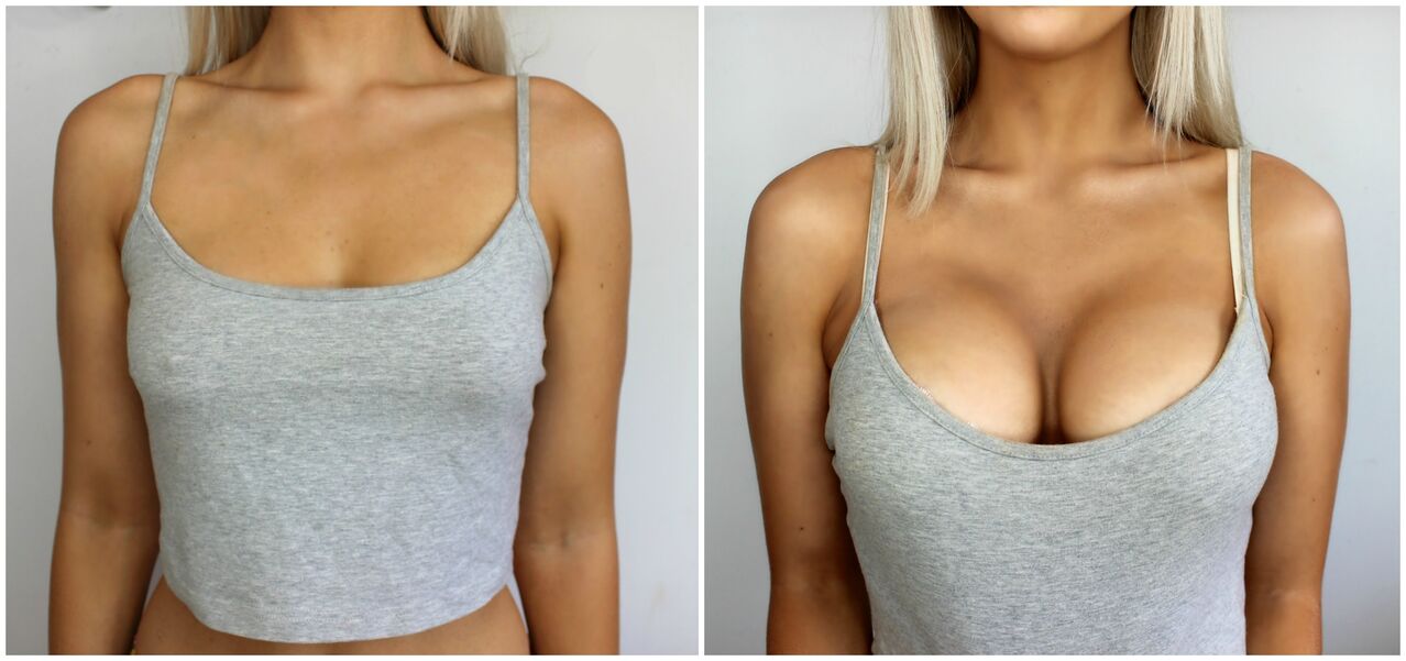 Operation before and after